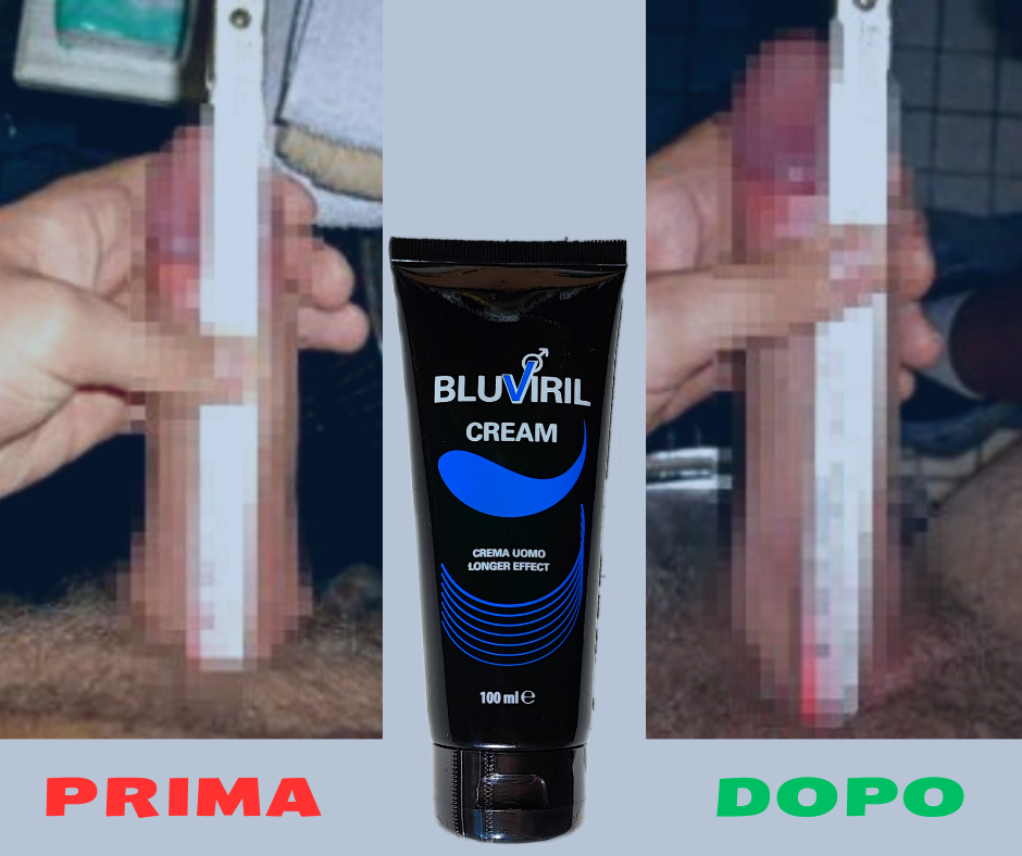 PRIMA DOPO5